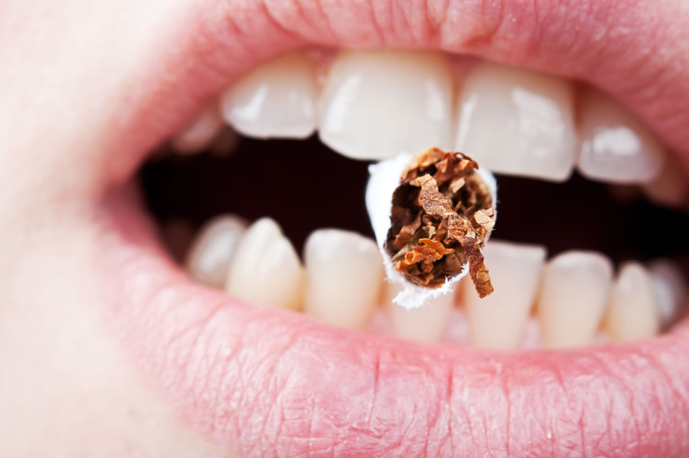 ¿Cómo afecta el tabaco a las encías?