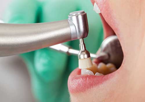 tratamientos dentales en pamplona